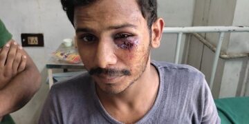 ஓட்டல் உரிமையாளருக்கு சரமாரி அடி-உதை: சேலம் தி.மு.க. கவுன்சிலர் மகன் அராஜகம்